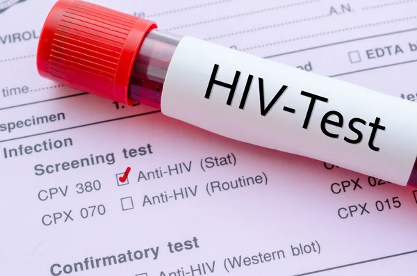 HIV infection screening test form.