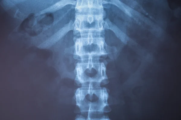 X-Ray image of human for a medical diagnosis