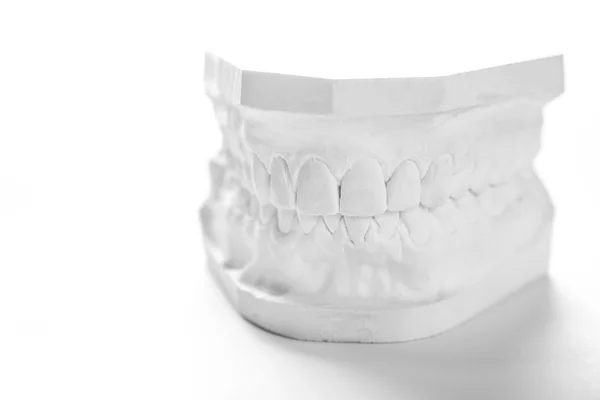 Gypsum model of human jaw on a white background.