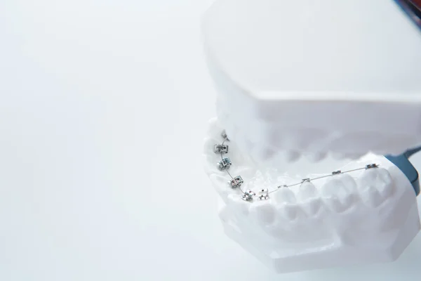 Dental lower jaw bracket braces model on white