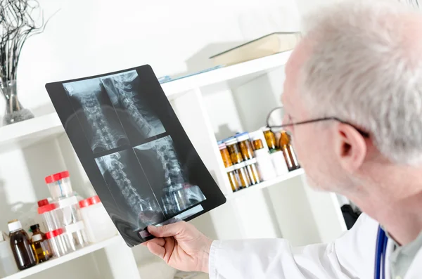 Doctor looking at a x-ray radiography