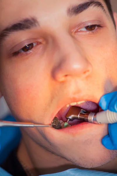 Dentist treatment a patients teeth in the dentist.