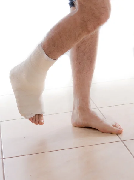 Young man with a broken ankle and a leg cast