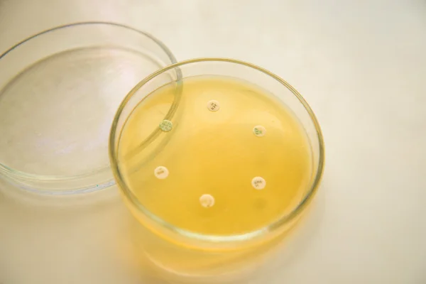 Discs with antibiotic on a Petri dish