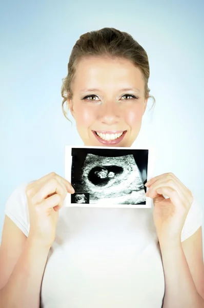 Beautiful smiling young woman in early pregnancy is posing with a baby scan photo.