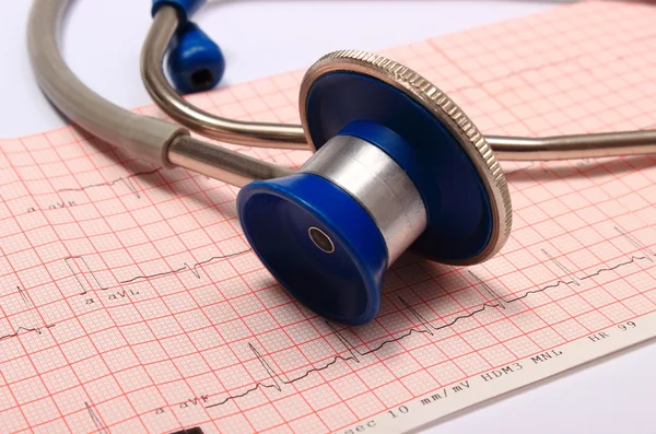 Stethoscope with electrocardiogram graph report