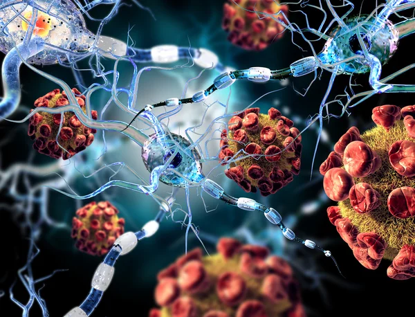 High quality 3d render of viruses attacking nerve cells, concept for Neurologic Diseases, tumors and brain surgery.