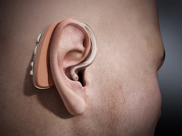Ear aid on ear