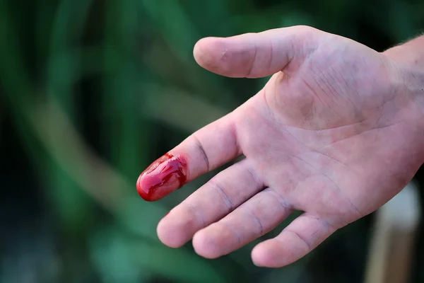 Finger cut