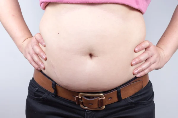 Close Up Belly Fat Women