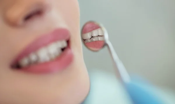 Healthy woman teeth and a dentist mouth mirror with grey clinic background, european beauty