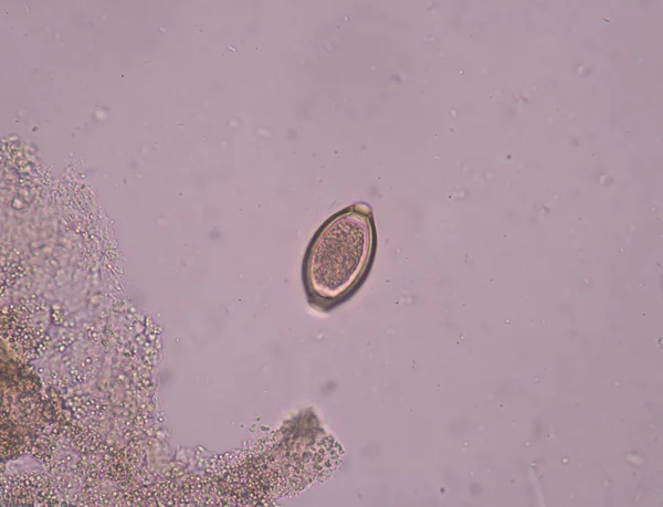 Egg parasite in stool