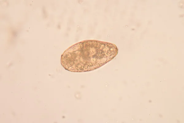 Parasite in stool exam