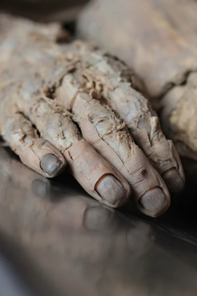 Dead person, the body, the hand, the skin is removed, fingers, nails
