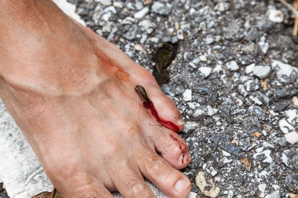 Tropical leech biting human foot on street beside asian rainfore