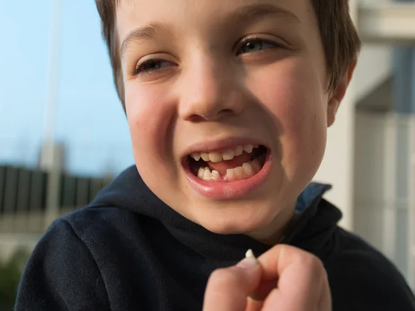 Young boy showing his first missing tooth