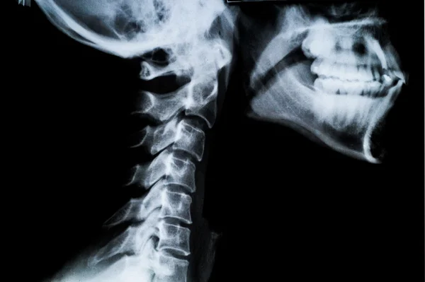 X ray neck and Jaw