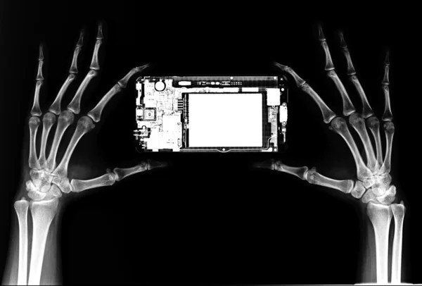 Hands skeleton and mobile phone on x-ray