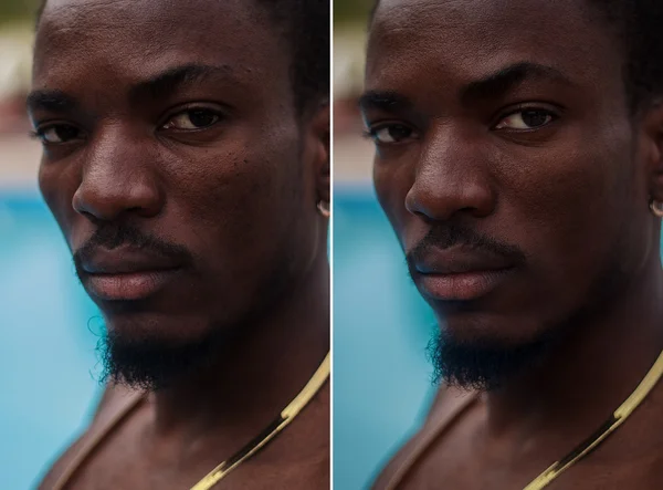 Before and after cosmetic operation. Young pretty man portrait