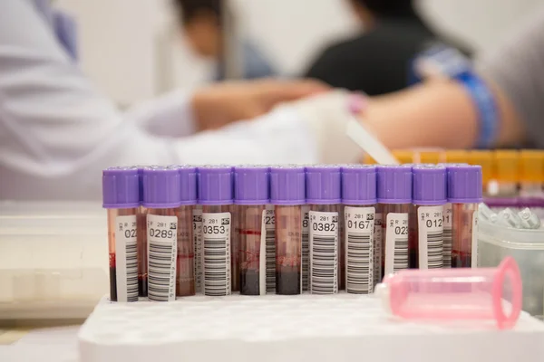 Blood sampling,blood tube for test