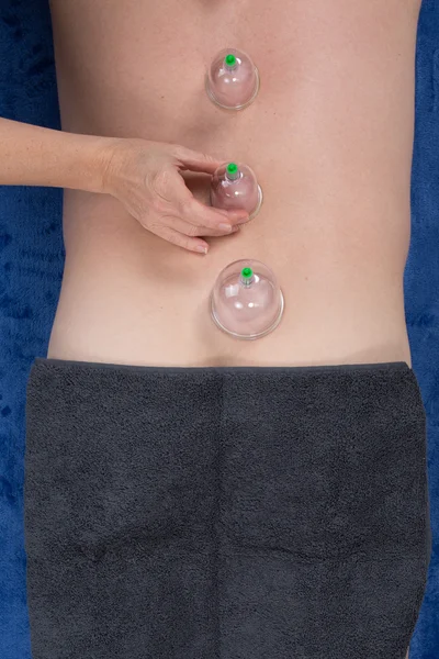 Close-up Of Person Hand Giving Cupping Treatment To man