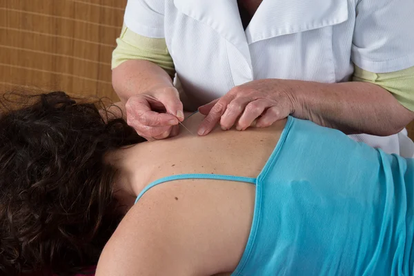 Bright caucasian woman receiving an acupuncture treatment