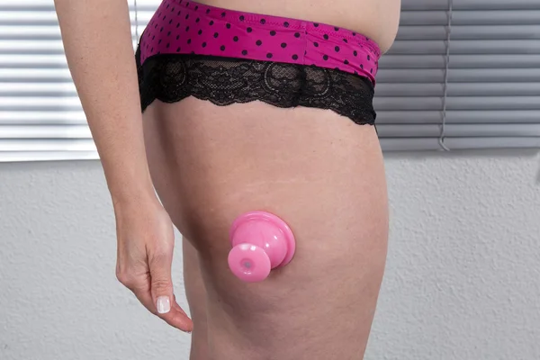 Woman cellulite