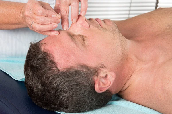 Man in an acupuncture therapy at the health spa