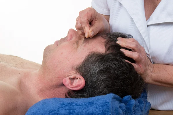 Acupuncture. Needles being inserted into a patient\'s face