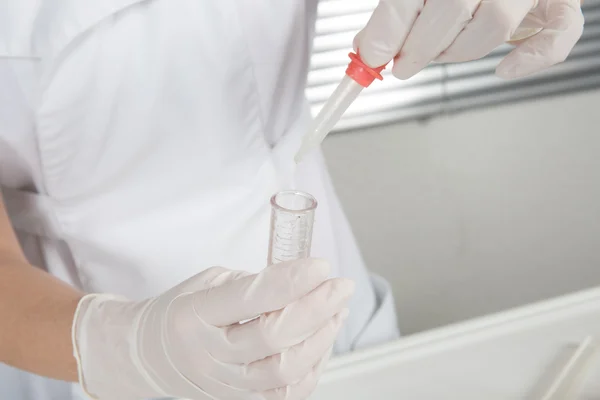 Scientists hands with pipette and test tube making research in clinical laboratory