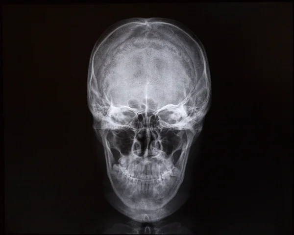 X-rays of skull and internal cavity. Medicine