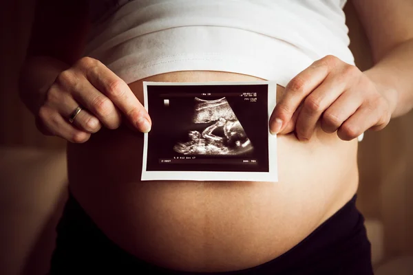 Pregnant woman holding ultrasound image
