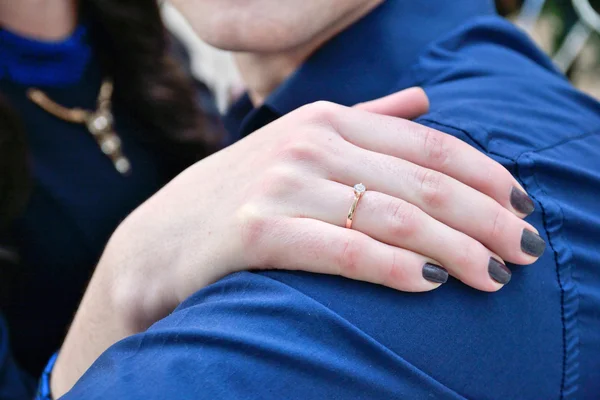 Hand of a woman on a man shoulder with engagement ring
