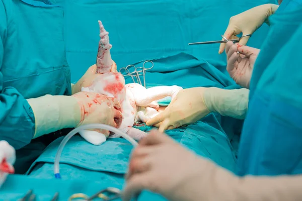 Real operation for cesarean section