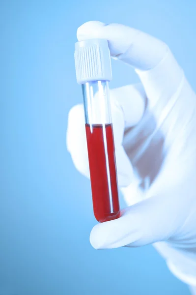 Hand holding blood in test tube take with blue filter