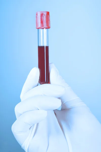 Hand holding blood in test tube take with blue filter