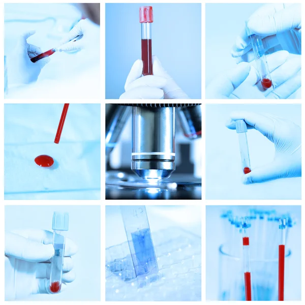 Mix of blood testing in laboratory take