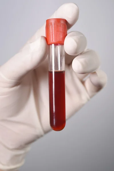 Blood test tube in a laboratory