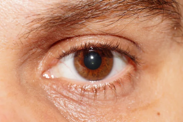 Eyes hazel (brown) color.