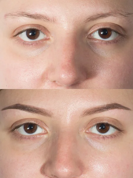 Part of face eyebrows before after