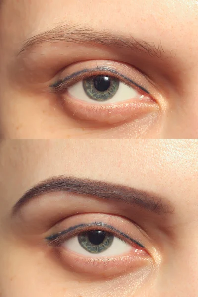 Eyebrows before after