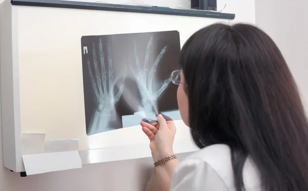 Female doctor examining an x-ray