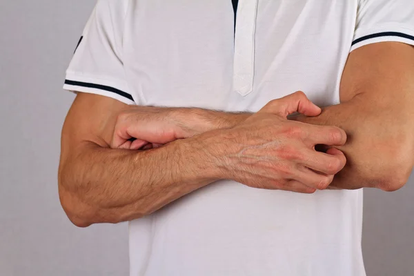 Man Scratching an itch. Skin,Allergic Reaction, Irritation