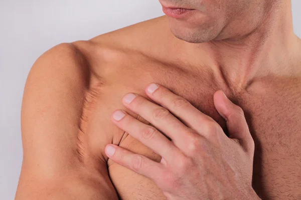 Man man with scar on his hand shoulder. Laser Scar Reduction concept