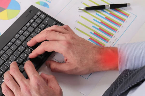 Businessman with wrist pain. Close up of man hands typing on computer keyboard