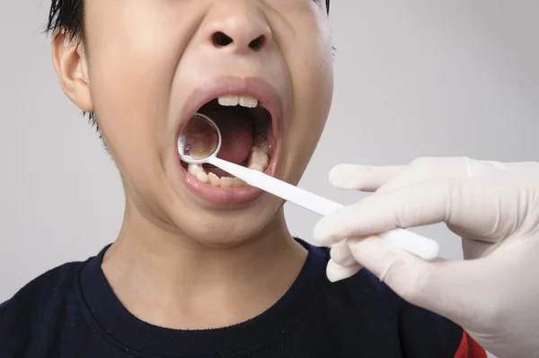 Boy checking tooth by mirror