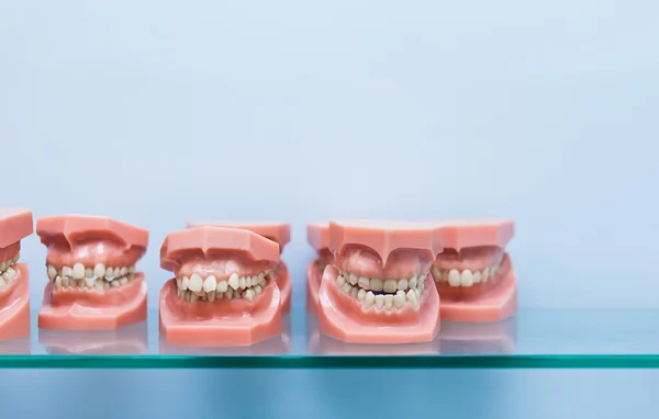 Row of educational jaw models with bad bite malocclusion in dentist office