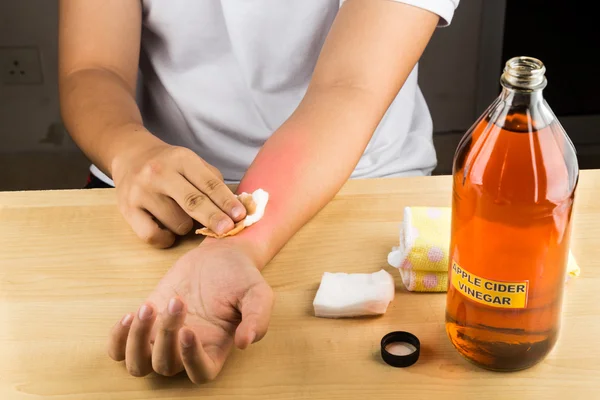Apple cider vinegar effective natural remedy for skin itch, fung