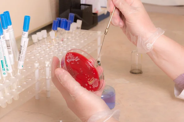 Testing of blood samples for diseases and hormones