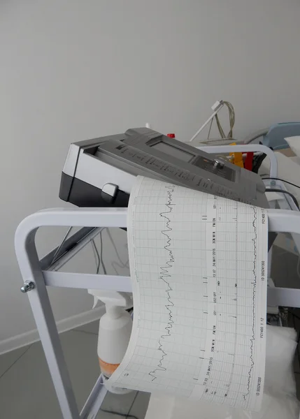 Cardiograph fixing and printing graphs of heart rate